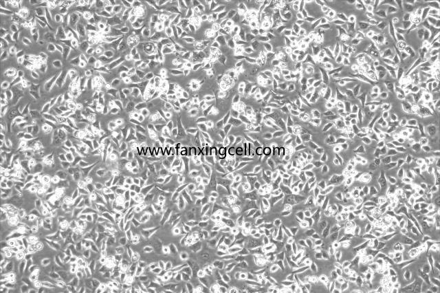 MKN-28 人胃癌高转移细胞