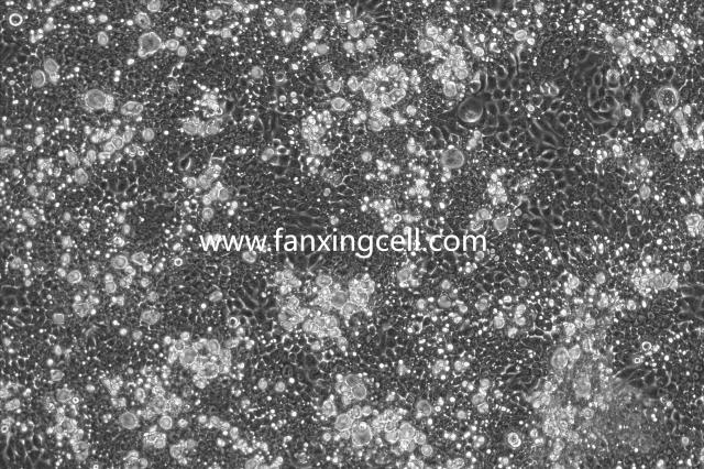 NCI-N87 人胃癌细胞